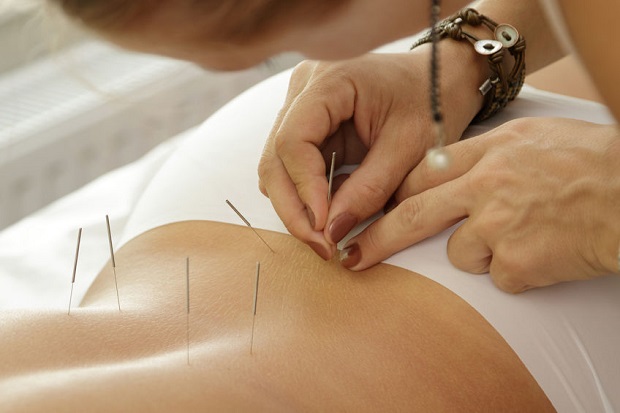 Acupuncture for Back Pain? 12 Studies Say It Works!