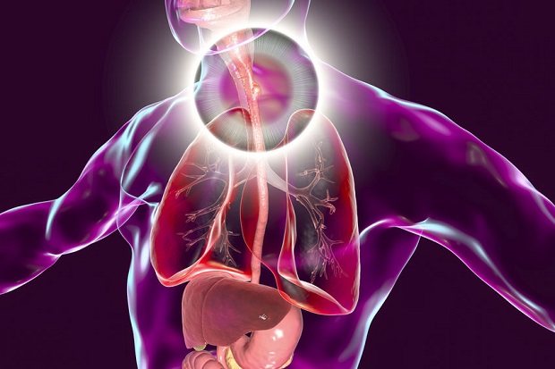 Can Acid Reflux Cause Cancer? | Sophisticated EDGE